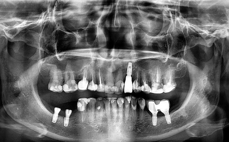 Снимок стоматология